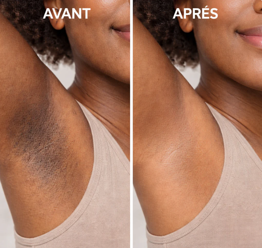 كريم ريتينال شوت لشد البشرة